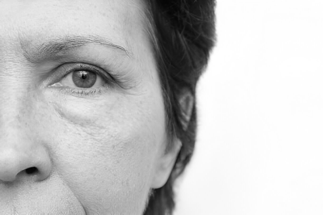permanently remove eye bags