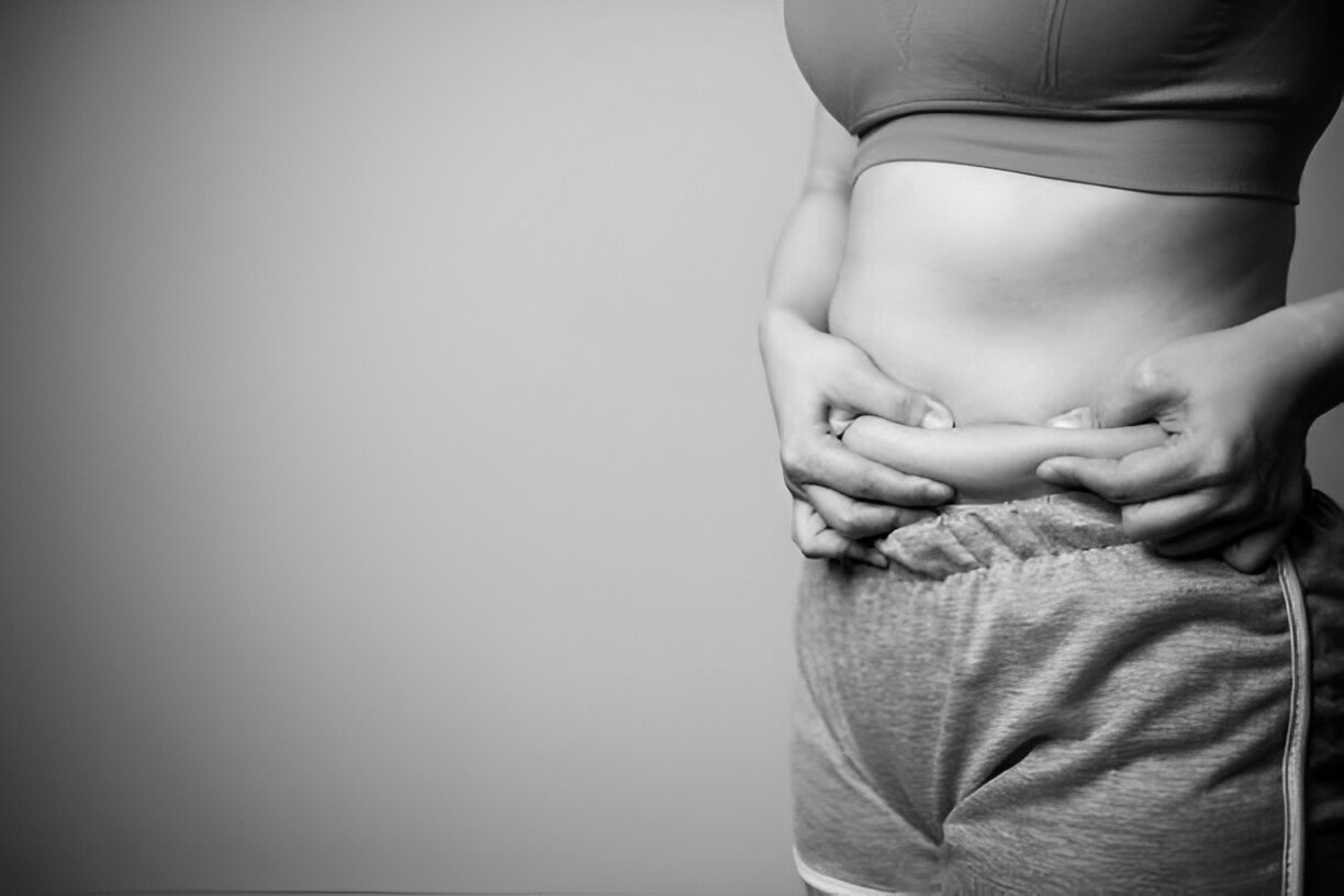 what is 360 liposuction