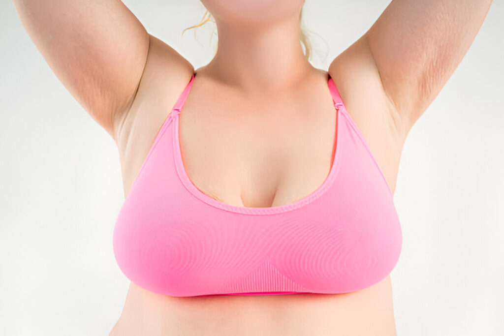 Saggy Breasts