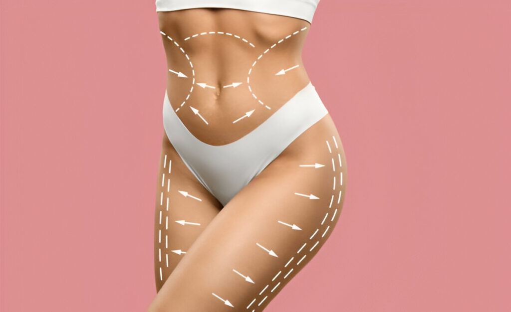 body contouring surgery South Africa