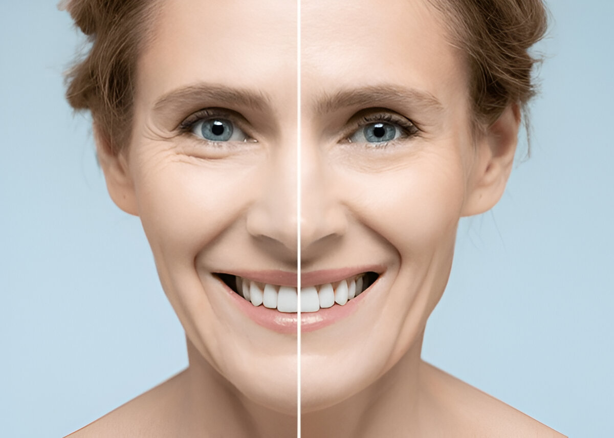 body contouring before and after