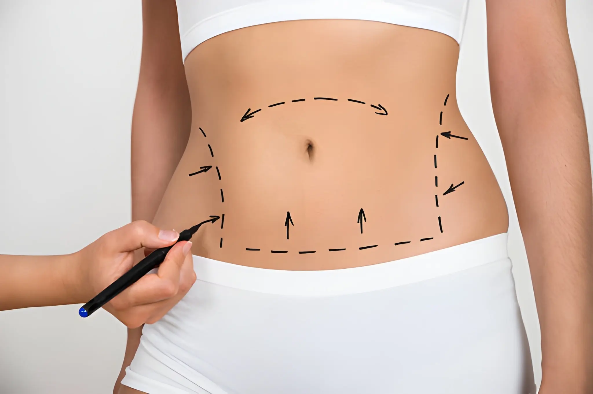 liposuction examination