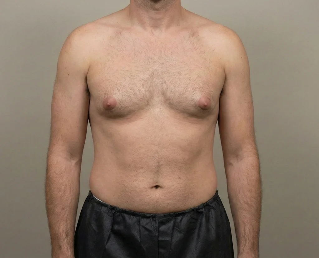 men with puffy nipple standing